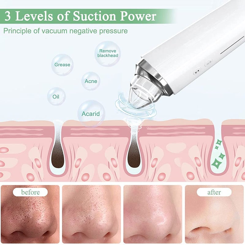 prabensei Blackhead Remover Pore Vacuum, ã€[FDA Certification] ã€‘ WiFi Visible Facial Pore Cleanser with HD Camera Pimple Acne Comedone Extractor Kit with 6 Suction Heads Electric Blackhead Suction Tool - Image 5